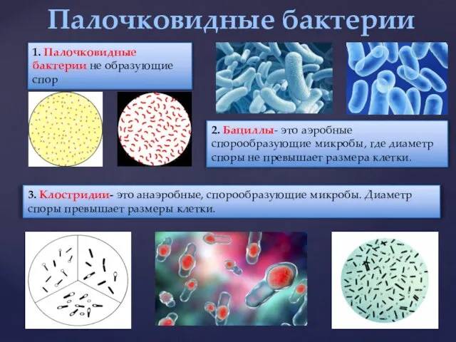Палочковидные бактерии 1. Палочковидные бактерии не образующие спор 2. Бациллы-
