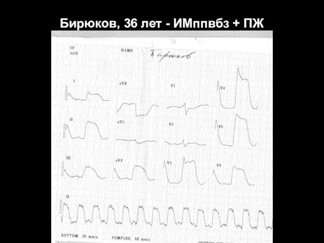 Бирюков, 36 лет - ИМппвбз + ПЖ