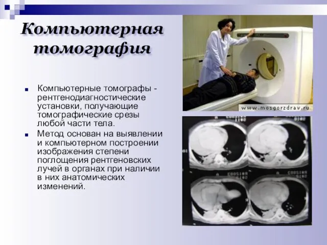 Компьютерная томография Компьютерные томографы - рентгенодиагностические установки, получающие томографические срезы любой части тела.