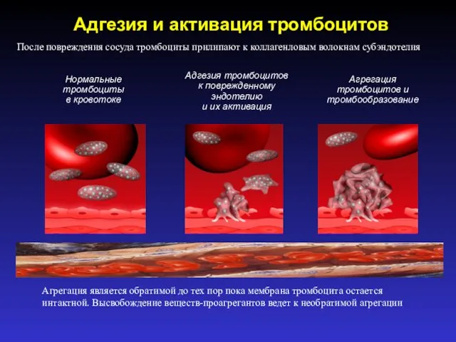 Адгезия и активация тромбоцитов Нормальные тромбоциты в кровотоке Агрегация тромбоцитов