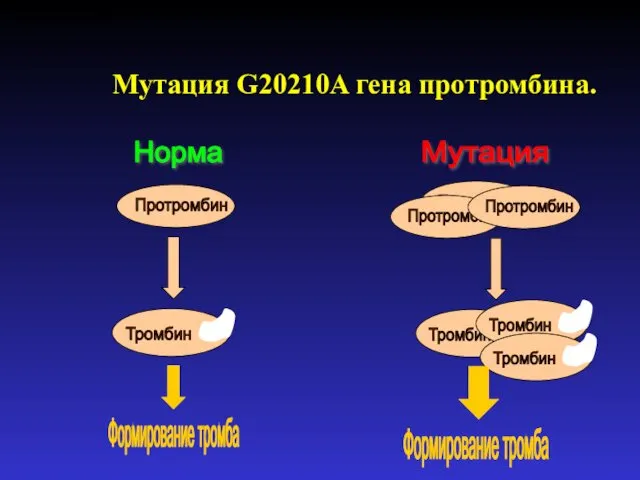 Мутация G20210A гена протромбина. Хитринская Е.Ю.