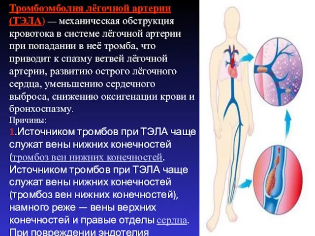 Тромбоэмболия лёгочной артерии (ТЭЛА) — механическая обструкция кровотока в системе