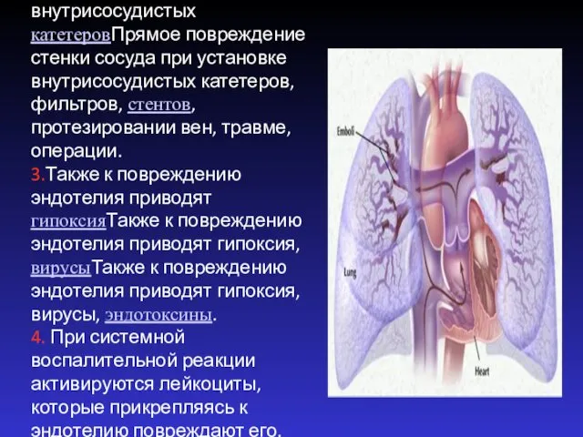 2.Прямое повреждение стенки сосуда при установке внутрисосудистых катетеровПрямое повреждение стенки