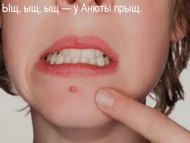 Ыщ, ыщ, ыщ — у Анюты прыщ.