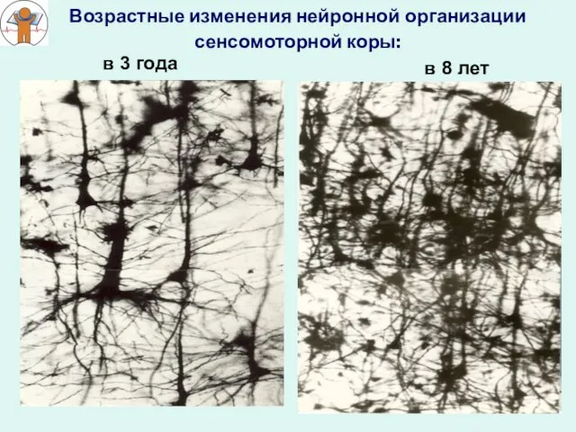 Возрастные изменения нейронной организации сенсомоторной коры: в 3 года в 8 лет