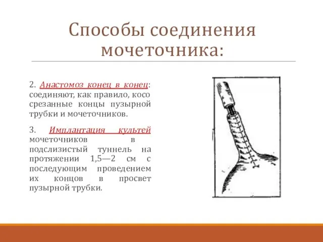 2. Анастомоз конец в конец: соединяют, как правило, косо срезанные