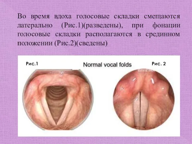 Во время вдоха голосовые складки смещаются латерально (Рис.1)(разведены), при фонации