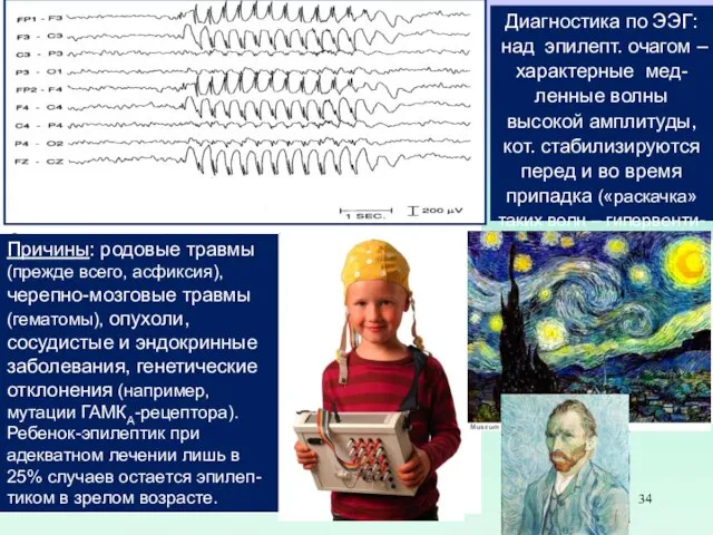 Эпилепсия. Около 0.5% населения (предрасположены ~2%). В большинстве случаев в