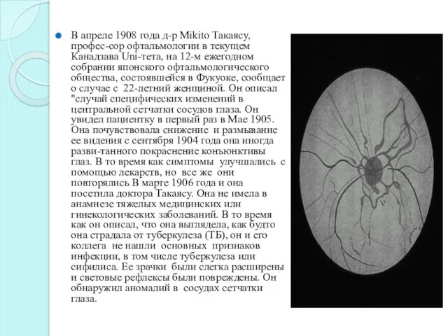 В апреле 1908 года д-р Mikito Такаясу, профес-сор офтальмологии в текущем Канадзава Uni-тета,