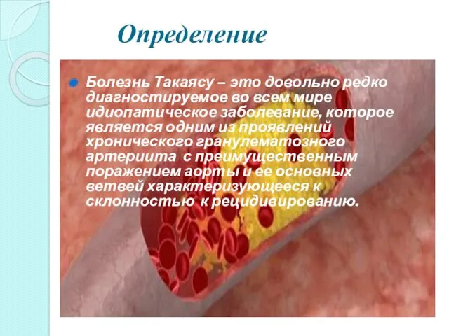 Определение Болезнь Такаясу – это довольно редко диагностируемое во всем