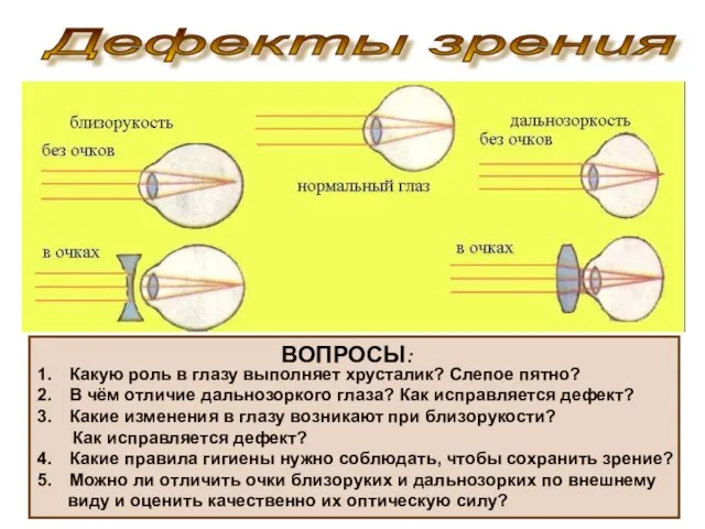 Дефекты зрения ВОПРОСЫ: Какую роль в глазу выполняет хрусталик? Слепое