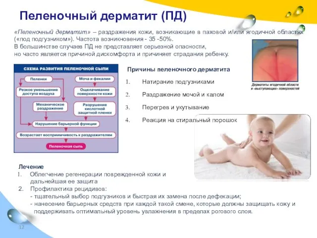 Пеленочный дерматит (ПД) «Пеленочный дерматит» – раздражения кожи, возникающие в