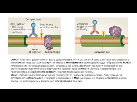 ОМАН: Антигены расположены возле узлов Ранвье. Анти-GM1 и анти-GD1a антитела