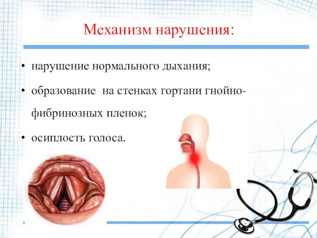 Механизм нарушения: нарушение нормального дыхания; образование на стенках гортани гнойно-фибринозных пленок; осиплость голоса.