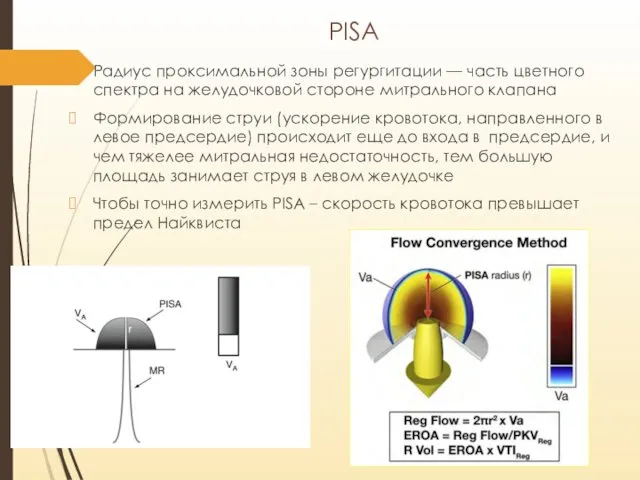 PISA Радиус проксимальной зоны регургитации — часть цветного спектра на