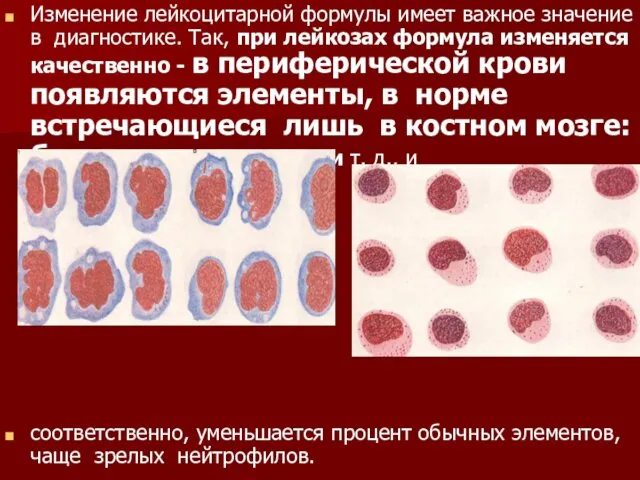 Изменение лейкоцитарной формулы имеет важное значение в диагностике. Так, при