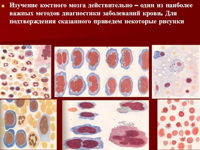 Изучение костного мозга действительно – один из наиболее важных методов