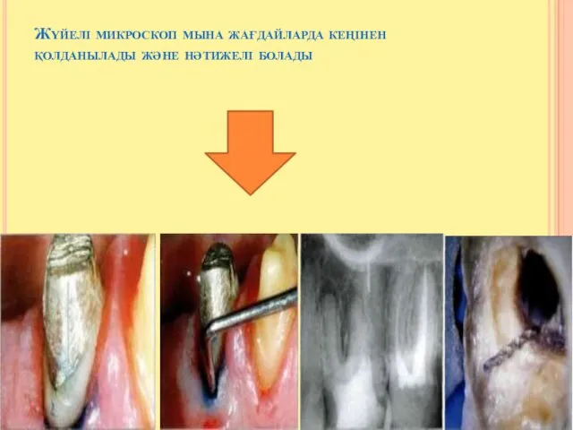 Жүйелі микроскоп мына жағдайларда кеңінен қолданылады және нәтижелі болады