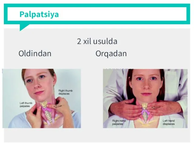 Palpatsiya 2 xil usulda Oldindan Orqadan