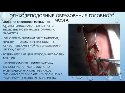 ОПУХОЛЕПОДОБНЫЕ ОБРАЗОВАНИЯ ГОЛОВНОГО МОЗГА. АБСЦЕСС ГОЛОВНОГО МОЗГА- ЭТО ОГРАНИЧЕННОЕ НАКОПЛЕНИЕ