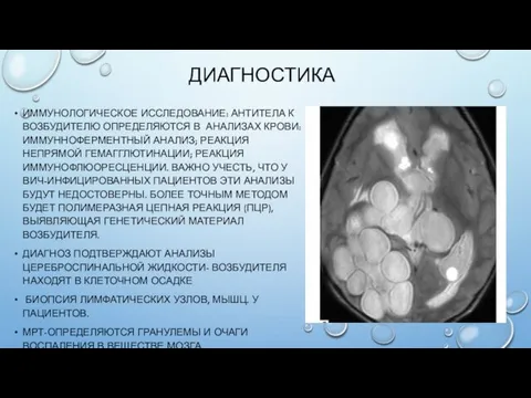 ДИАГНОСТИКА ИММУНОЛОГИЧЕСКОЕ ИССЛЕДОВАНИЕ: АНТИТЕЛА К ВОЗБУДИТЕЛЮ ОПРЕДЕЛЯЮТСЯ В АНАЛИЗАХ КРОВИ: