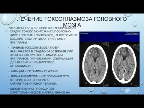 ЛЕЧЕНИЕ ТОКСОПЛАЗМОЗА ГОЛОВНОГО МОЗГА ЭТИОТРОПНОГО ЛЕЧЕНИЯ ДЛЯ ХРОНИЧЕСКОЙ СТАДИИ ТОКСОПЛАЗМОЗА