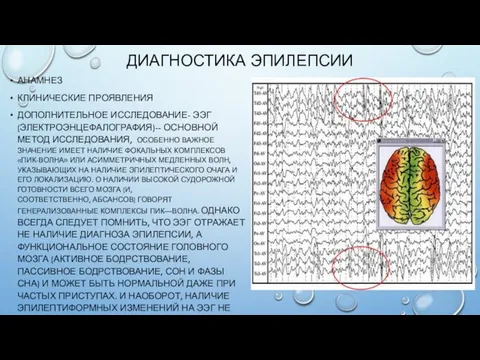 ДИАГНОСТИКА ЭПИЛЕПСИИ АНАМНЕЗ КЛИНИЧЕСКИЕ ПРОЯВЛЕНИЯ ДОПОЛНИТЕЛЬНОЕ ИССЛЕДОВАНИЕ- ЭЭГ (ЭЛЕКТРОЭНЦЕФАЛОГРАФИЯ)-- ОСНОВНОЙ