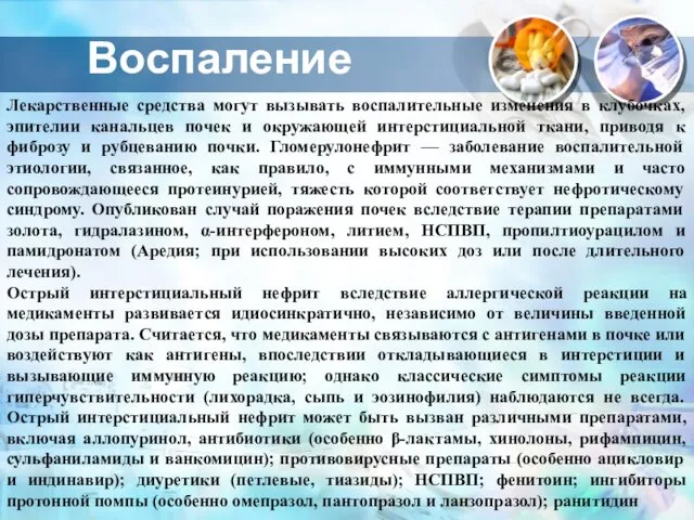 Воспаление Лекарственные средства могут вызывать воспалительные изменения в клубочках, эпителии канальцев почек и