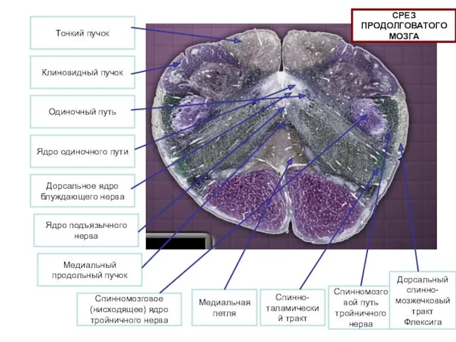 Тонкий пучок Клиновидный пучок Одиночный путь Ядро одиночного пути Дорсальное