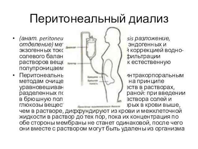 Перитонеальный диализ (анат. peritoneum брюшина: греч. dialysis разложение, отделение) метод