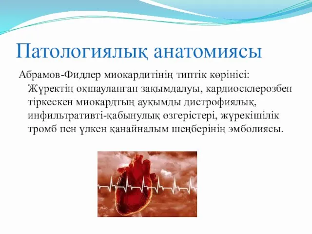 Патологиялық анатомиясы Абрамов-Фидлер миокардитінің типтік көрінісі: Жүректің оқшауланған зақымдалуы, кардиосклерозбен