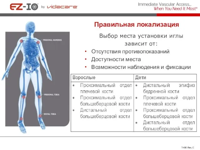 Правильная локализация Выбор места установки иглы зависит от: Отсутствия противопоказаний