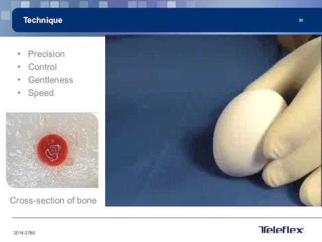 Technique Precision Control Gentleness Speed Cross-section of bone