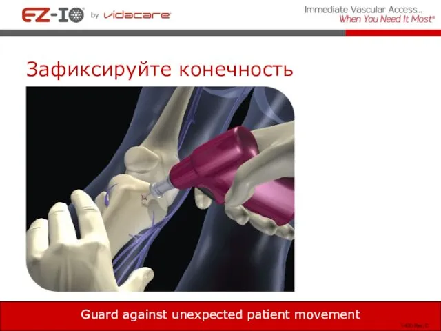 Зафиксируйте конечность Guard against unexpected patient movement T-430 Rev, C