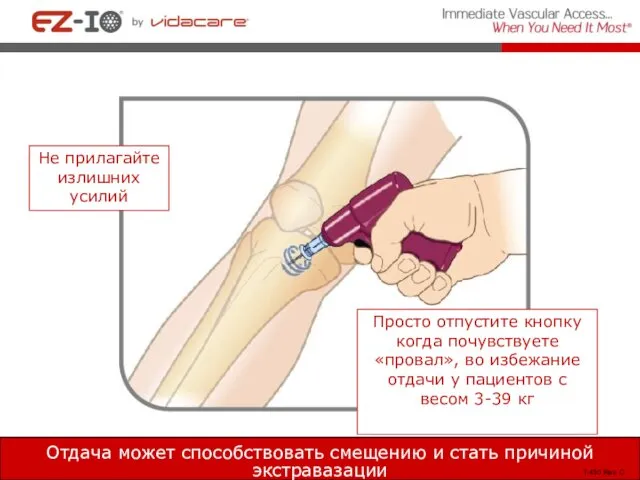 Отдача может способствовать смещению и стать причиной экстравазации Не прилагайте