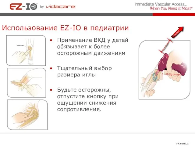 Использование EZ-IO в педиатрии Применение ВКД у детей обязывает к