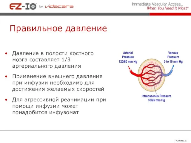 Правильное давление Давление в полости костного мозга составляет 1/3 артериального