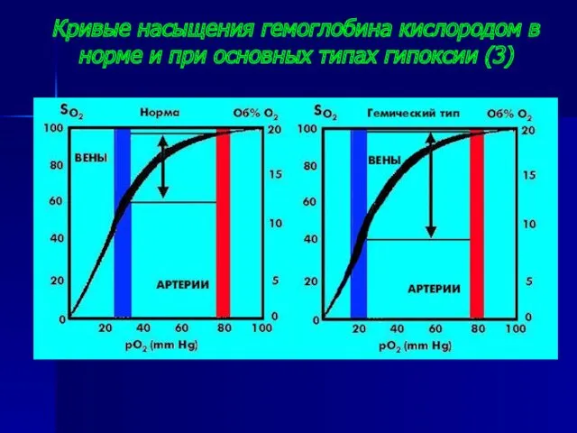 Кривые насыщения гемоглобина кислородом в норме и при основных типах гипоксии (3)