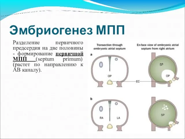 Эмбриогенез МПП Разделение первичного предсердия на две половины - формирование