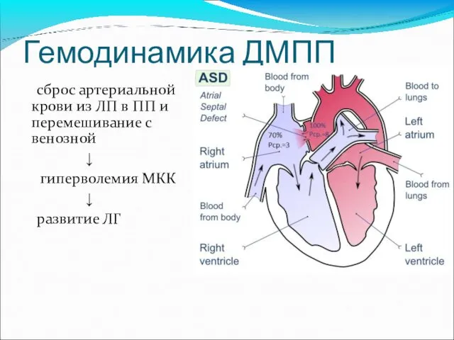 Гемодинамика ДМПП сброс артериальной крови из ЛП в ПП и