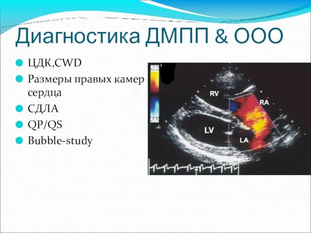 Диагностика ДМПП & ООО ЦДК,CWD Размеры правых камер сердца СДЛА QP/QS Bubble-study