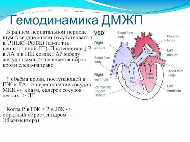 Гемодинамика ДМЖП В раннем неонатальном периоде шум в сердце может