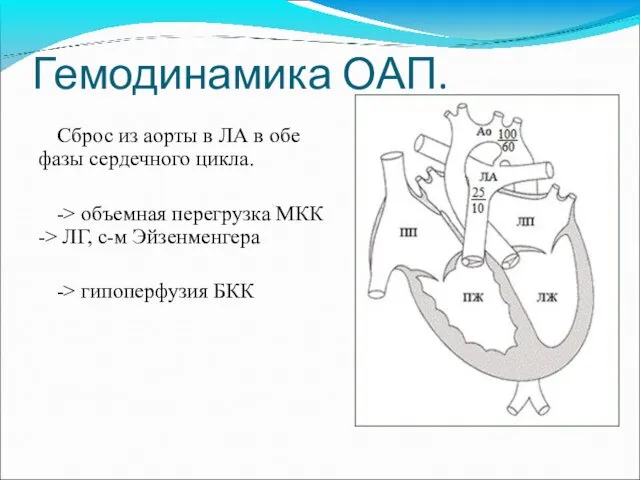 Гемодинамика ОАП. Сброс из аорты в ЛА в обе фазы