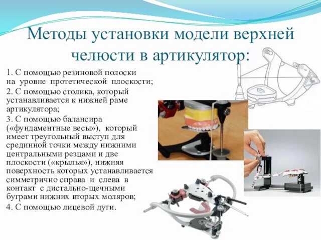 Методы установки модели верхней челюсти в артикулятор: 1. С помощью резиновой полоски на