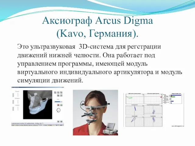 Аксиограф Arcus Digma (Kavo, Германия). Это ультразвуковая 3D-система для регстрации движений нижней челюсти.