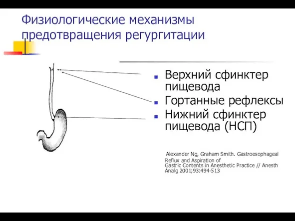 Физиологические механизмы предотвращения регургитации Верхний сфинктер пищевода Гортанные рефлексы Нижний