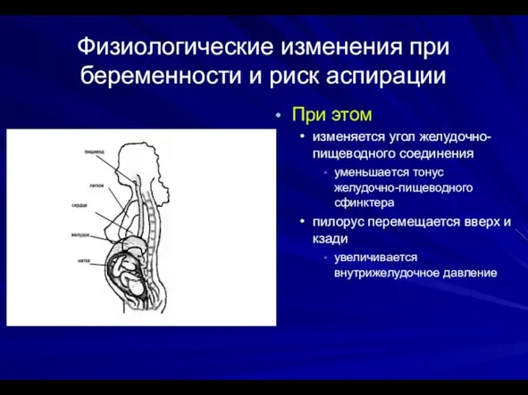 Физиологические изменения при беременности и риск аспирации При этом изменяется