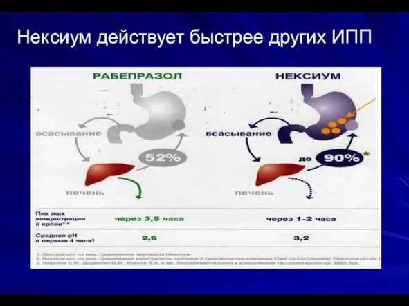 Нексиум действует быстрее других ИПП