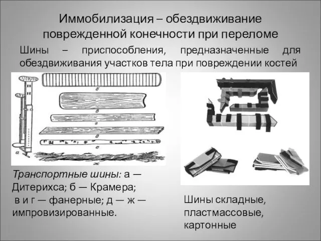 Иммобилизация – обездвиживание поврежденной конечности при переломе Шины – приспособления,