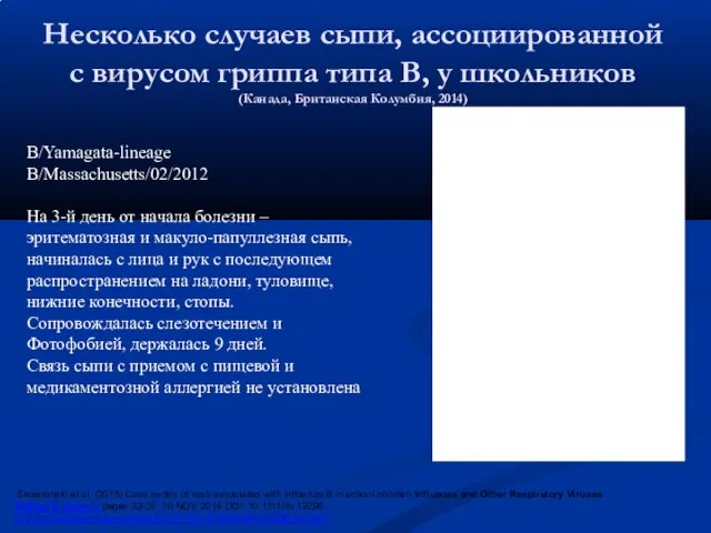 Несколько случаев сыпи, ассоциированной с вирусом гриппа типа В, у